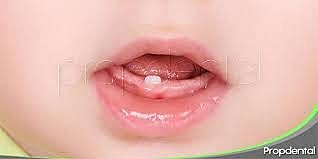 the first teeth appeared in 2004