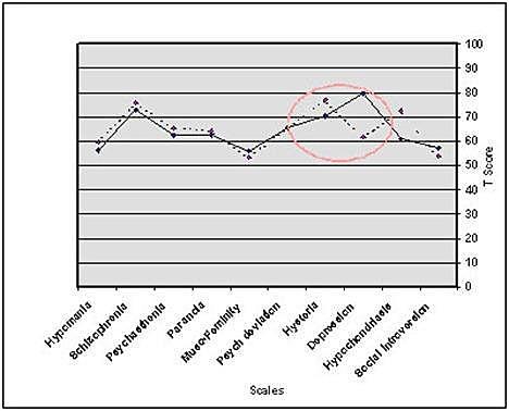Hathaway y McKinley 1943