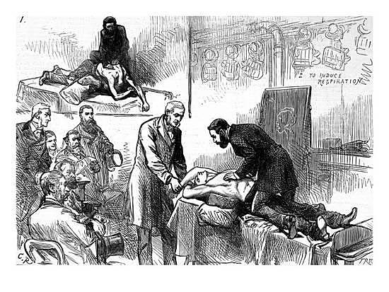 Métodos manuales de respiración artificial