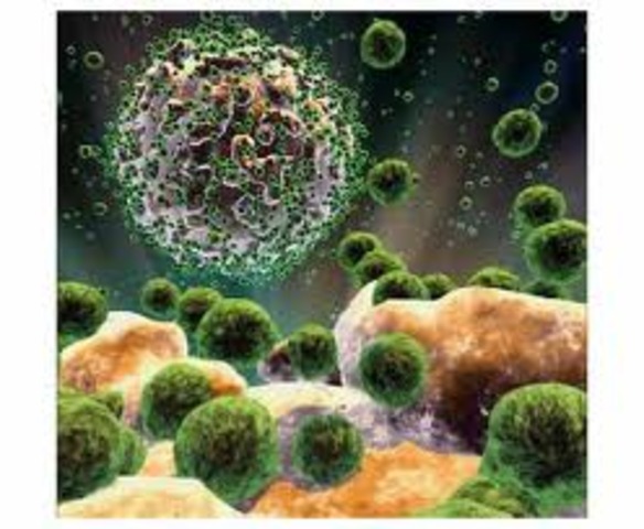 First notation of AIDS