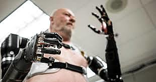 Bionic Prosthetics