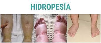 Muerte de Heráclito