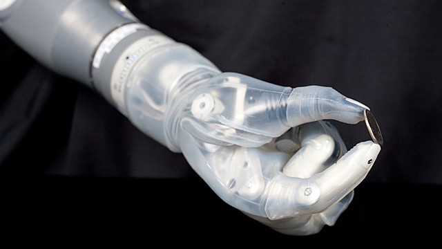 Bionic Prosthetic