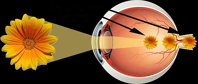 EL ASTIGMATISMO OCULAR