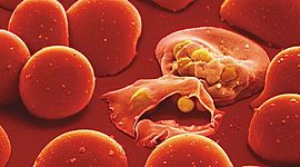 Timeline: The History of Malaria