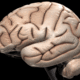 Brain 1