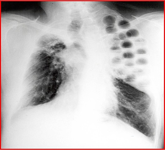 Época quirúrgica 2