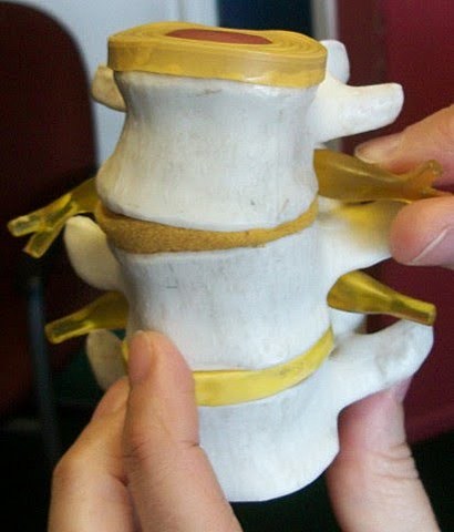 Demineralized Bone Matrix Gel