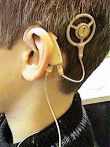 Cochlear Implant development