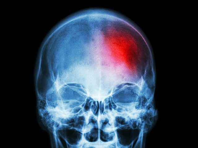 The Beginning of Her Health Decline