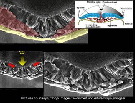 GASTRULACIÓN (3ra a 8va semana)