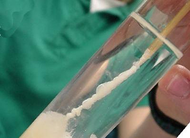 Απομόνωση DNA