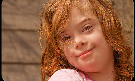 Asociacion Americana de Retraso Mental