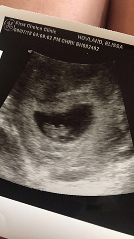 Seeing baby for the first time