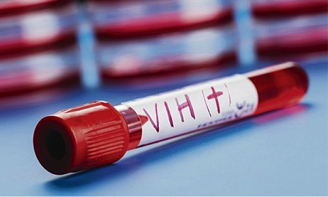 Identificación del VIH