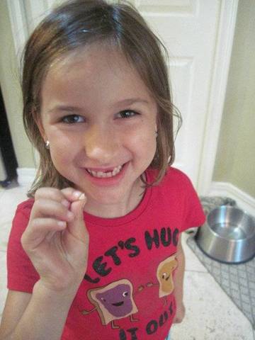 Lost 1st tooth