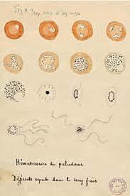 Key discovery against malaria Charles L. Laveran