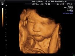 What is the evolution ?