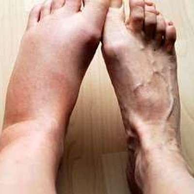 Timeline: ΑΝΤΙΜΕΤΩΠΙΣΗ ΦΛΕΓΜΟΝΗΣ ΜΕ ΦΥΣΙΚΑ ΜΕΣΑ