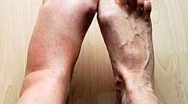 Timeline: ΑΝΤΙΜΕΤΩΠΙΣΗ ΦΛΕΓΜΟΝΗΣ ΜΕ ΦΥΣΙΚΑ ΜΕΣΑ