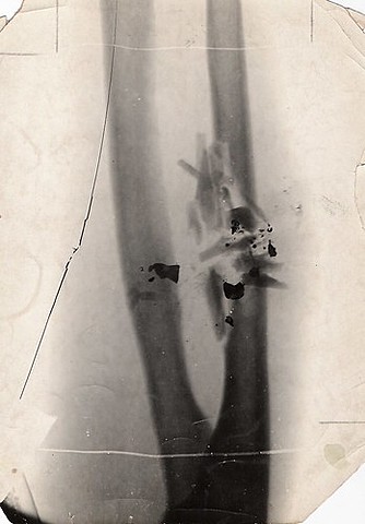 Marie Curie helps out in the medical field