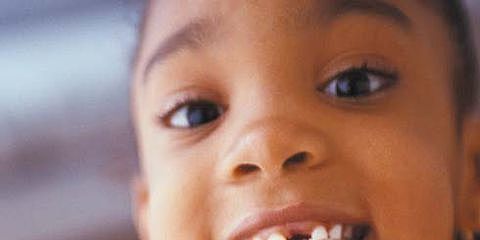 MUDANDO EL PRIMER DIENTE