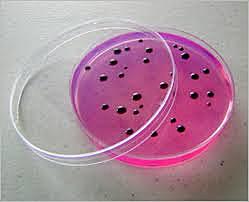 Richard Petri (Microbiólogo Alemán)