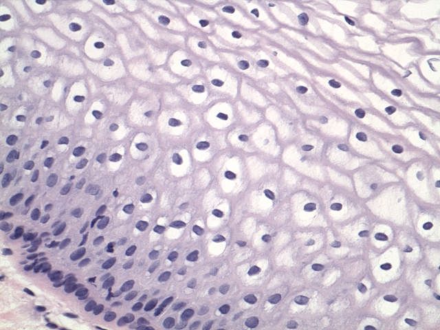 The Treatment Of Immortal