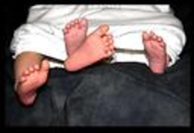 Twins Were Born