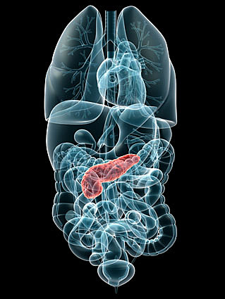 SE LE DIAGNOSTICA CÁNCER DE PÁNCREAS