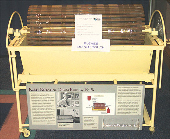 Kidney Dialysis Machine Invented