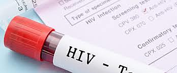 Development of ELISA test to screen for diseases such as HIV