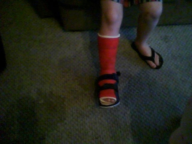 Skyler breaks his foot & has to get a cast