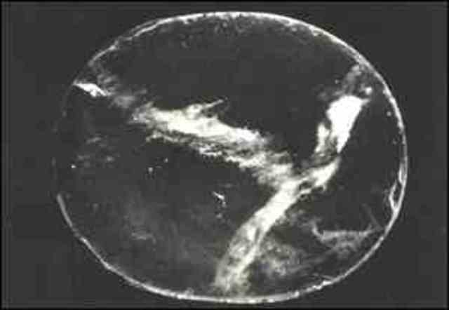 quand les lentilles etait invente