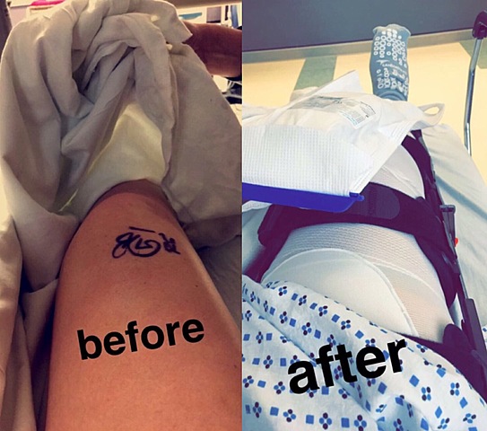 Giving up during Recovery