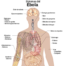 El Ébola comenzó a esparcirse de a poco por África