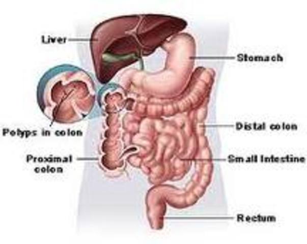 Colon Cancer Screening
