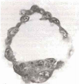 Día 5. Formación del blastocito
