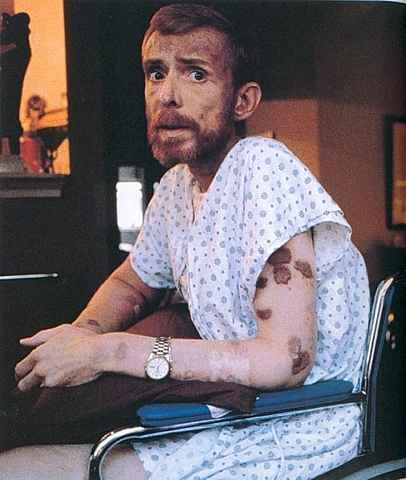 Nueva enfermedad Mortal