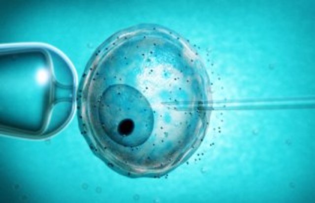Vitro Fertilization