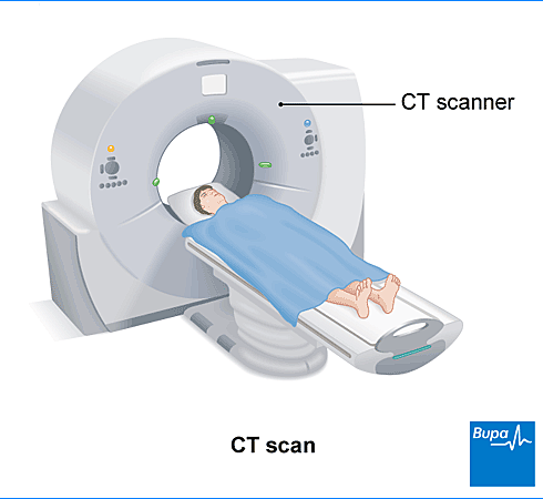 The CT Scanner