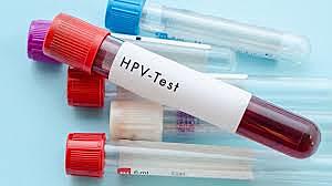 Cervical Cancer Screening - Pap Smear and HPV Test