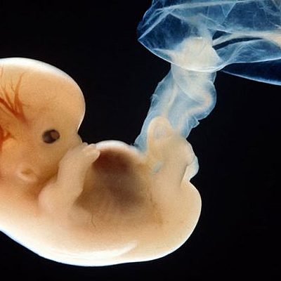 Timeline: Ontogénesis del Sistema Nervioso