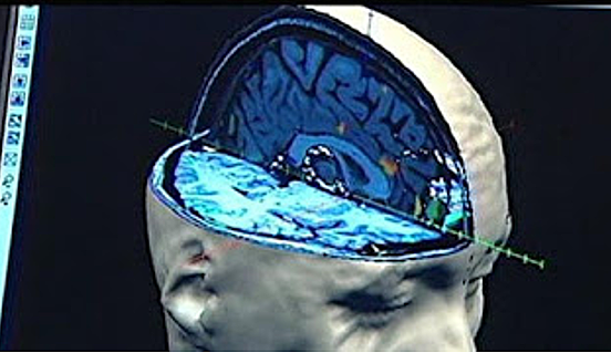 DESARROLLO DE GEL TRANSPARENTE QUE PERMITE VER EL INTERIOR DE LA CÉLULA