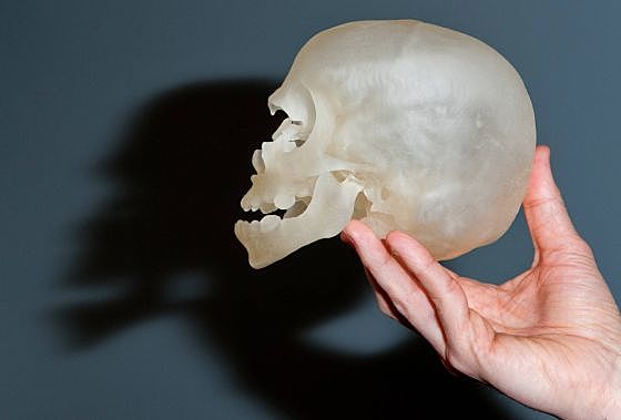 Primer cráneo impreso 3D