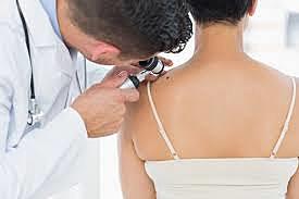 Skin Cancer Related Check up