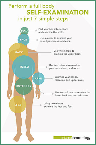 Self Skin Examinations