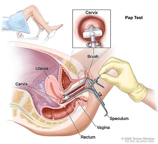 Cervical Cancer Screen