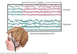 EEG