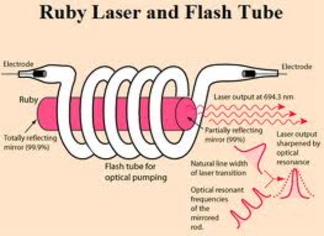 Première utilisation médicale de l'laser à rubis